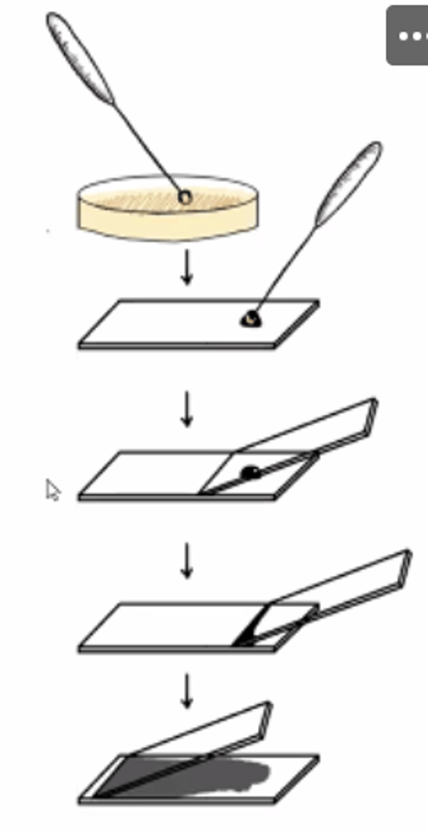 <p>IZMANTOJAM 2 priekšmetstikliņus!</p><p>1. Uzpilinam ___ šķidrumu uz priekšmetstikliņa (maliņā, nevis pa centru).</p><p>2. Ar bakterioloģisko cilpu, sterilizējam ar ugums liesmu.</p><p>3. Paņemam baktēriju kultūru.</p><p>4. Iemaisām kultūru krāsvielā (tajā pilienā uz pirmā stikliņa).</p><p>5. Sterilizējam cilpu.</p><p>6. Ar otro stikliņu šķidrumu dzenam uz priekšu pie nosaukuma, tad atpakaļ pie citas malas.</p>