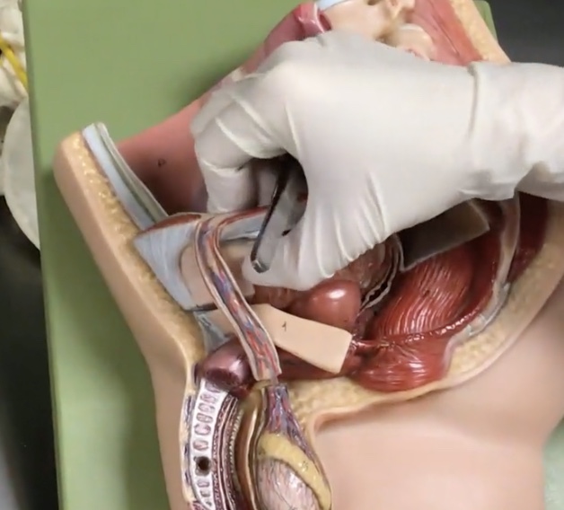 <p>Description: Paired bundle of vessels extending from the deep inguinal ring to the testis</p><p>Relationship: N/A</p>