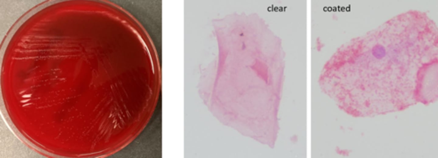 <p>-very tiny on blood agar</p><p>-Gram-negative (variable) coccobacilli</p><p>-Hippurate hydrolysis</p>