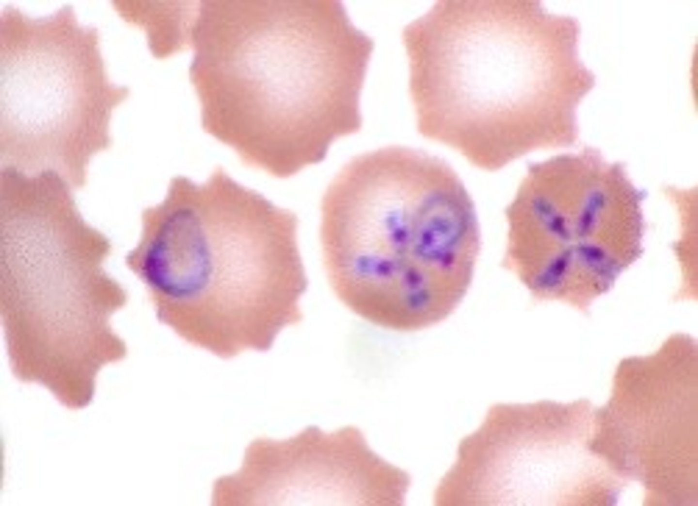 <p>This organism mimics "Plasmodium falciparum" because many can infect a single RBC. It usually infects domestic and wild animals, but can cause human infection. The tetrad or "Matese cross" forms a characteristics. What parasites are present?</p>
