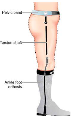 <p>correct angular and rotational deformities.</p>