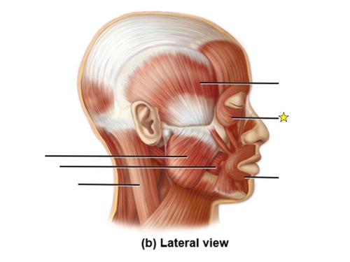 <p>identify the muscle</p>