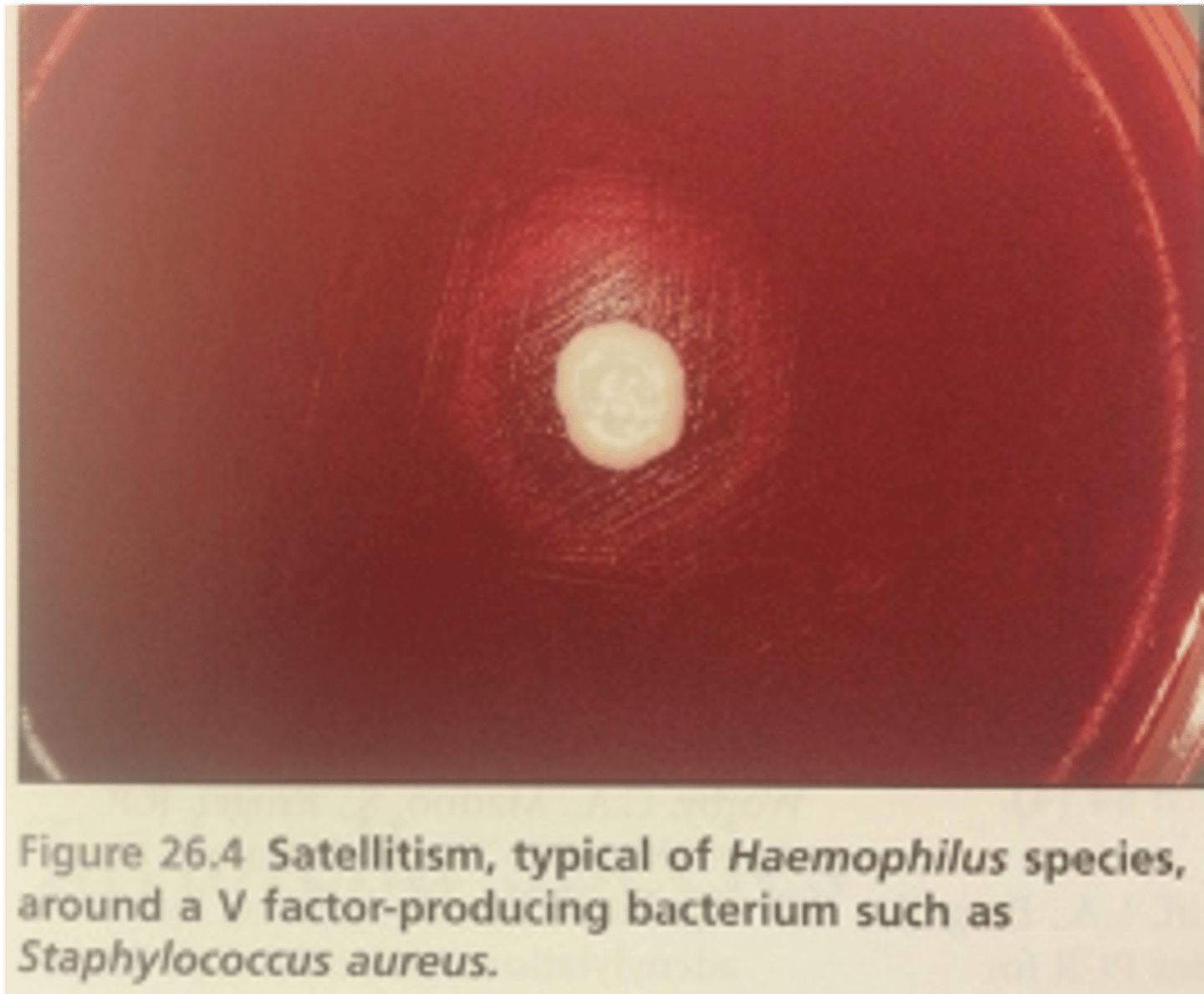 <p>what is satellitism</p>