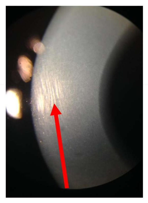 <p>Name the finding.</p>