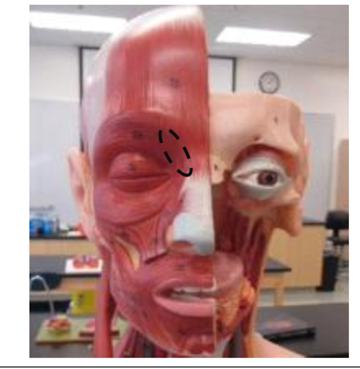 <p>25 more medial superior portion</p>