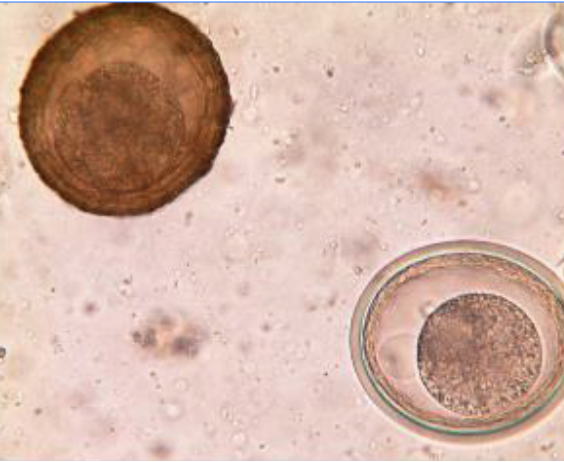 <p>Identify which parasite these eggs belongs to.</p>