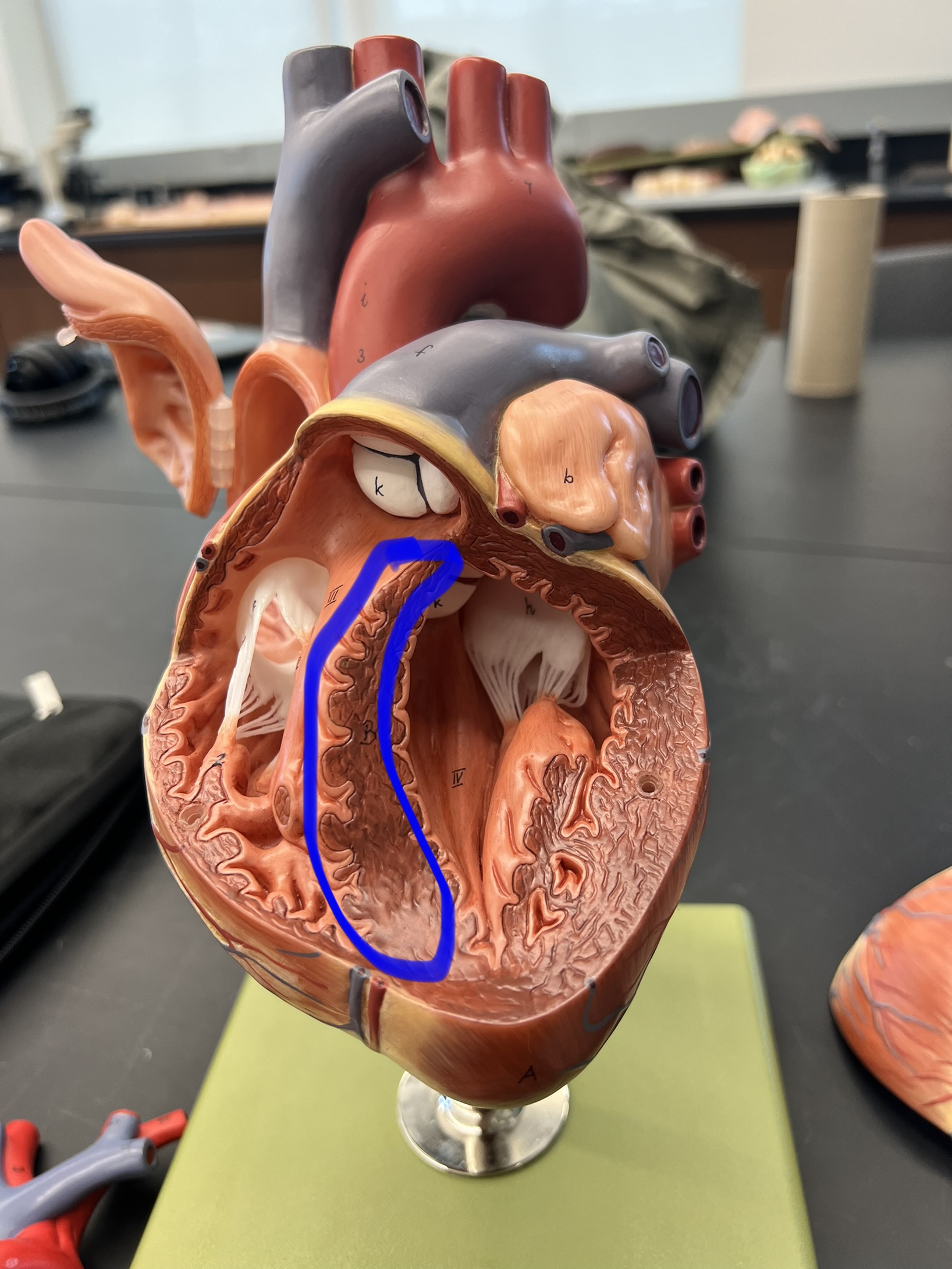 Name the heart structure.