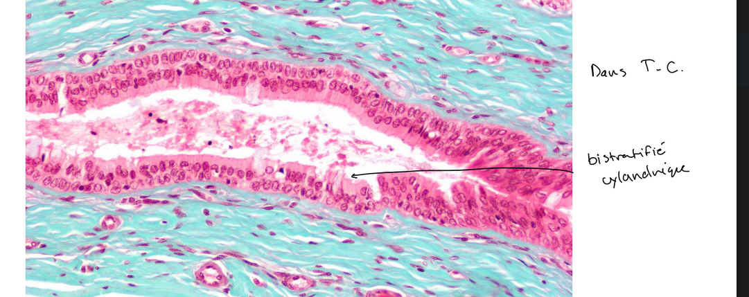 <p>CANAL COLLECTEUR → BISTRATIFIE</p>