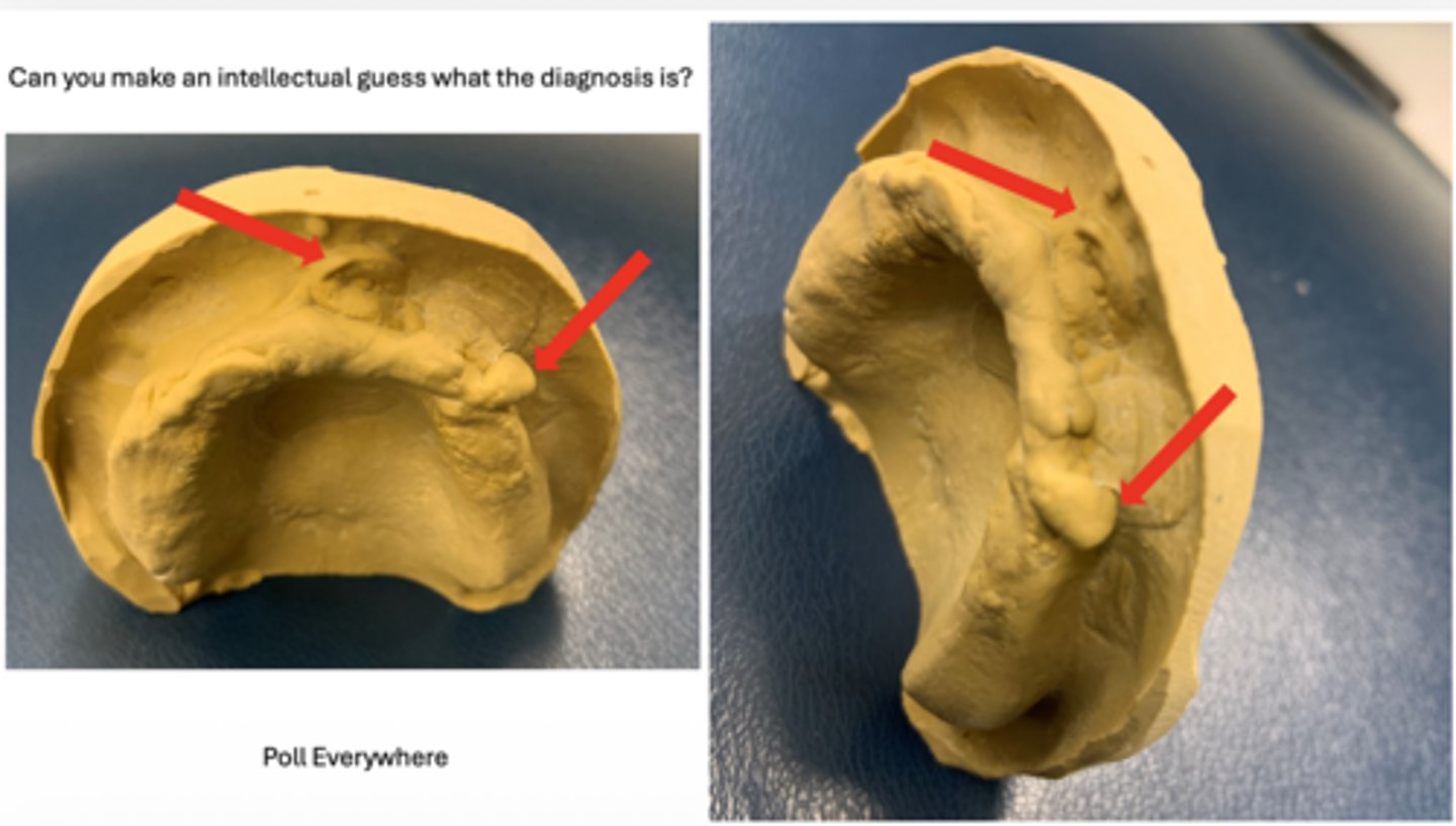<p>Can you make an intellectual guess what the diagnosis is?</p>