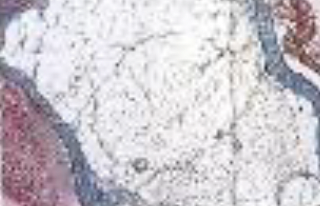 <p>Identifica el tejido</p>