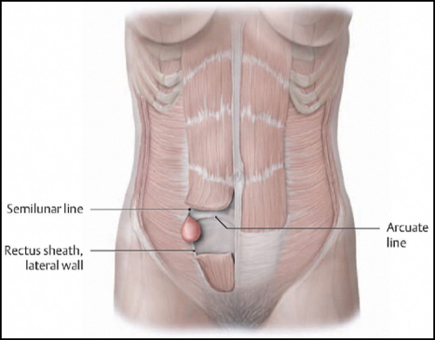 <p>DEFINITION</p><p>Between transverse abdominus and rectus muscles</p>
