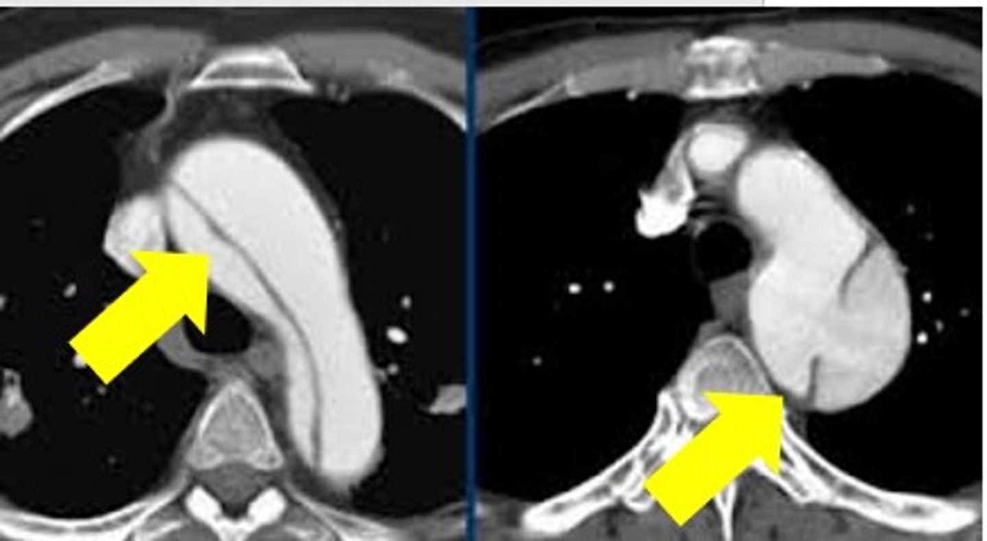 <p>Label pathology in the two images below</p>