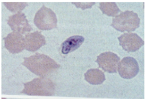 <p>What are morphology features of Plasmodium gametocytes?</p>
