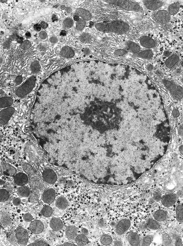 <p>Prokaryote, plant or animal cell?</p>