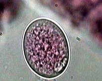 <p>Paraspidodera uncinata</p>