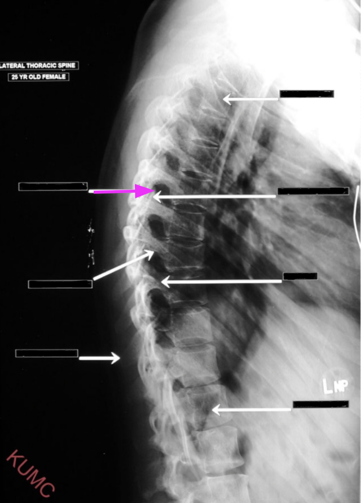 <p>What structure is referenced by the arrow highlighted in pink?</p>