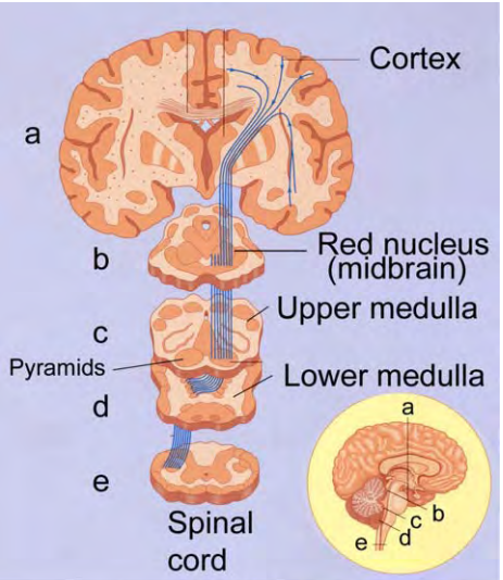 <p>In Figure 13.14, what is the plane of section of the top brain illustration (a)? ______________ Of the bottom illustration (e)? __</p>