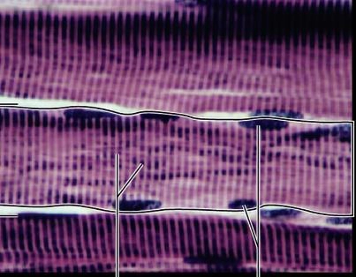 <p>The smallest functional unit of skeletal muscle is the sarcomere, composed of repeating myofibril structures.</p>