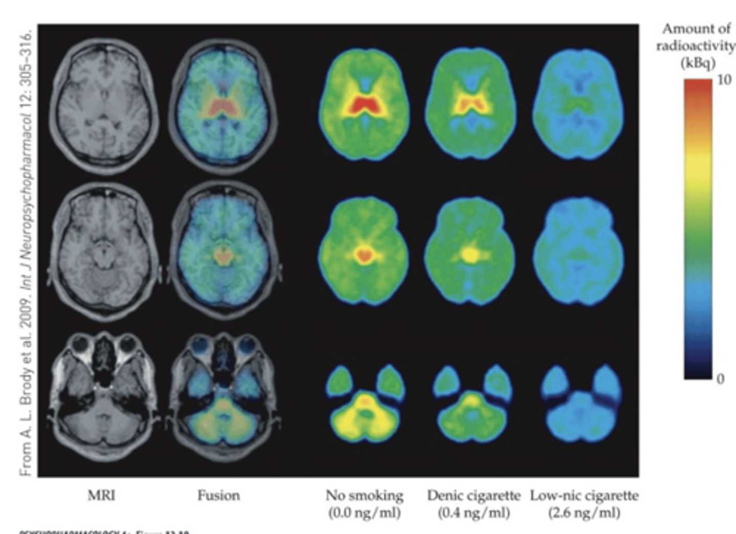 <p>- PET imaging of Tobacco- dependent cigarette smokers with a radiolabeled drug that binds selectively to α4β2 subunit–containing nAChRs in the brain</p><p>- even low levels of nicotine cause significant occupancy of high-affinity nAChRs in multiple brain areas</p><p>- Radiotracer is displaced by nicotine!</p>