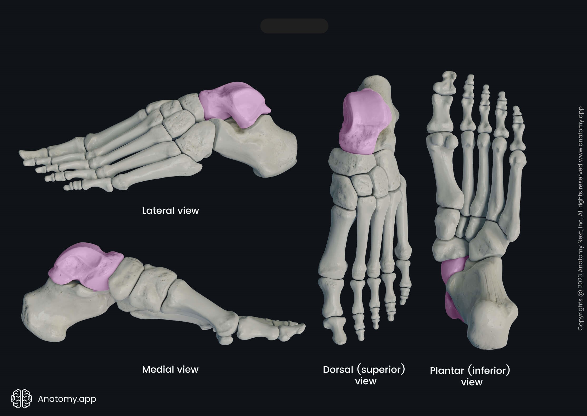 <p>What bone is this?</p>