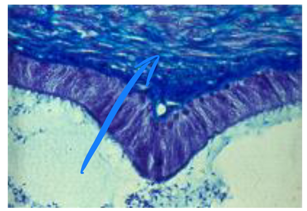 term image