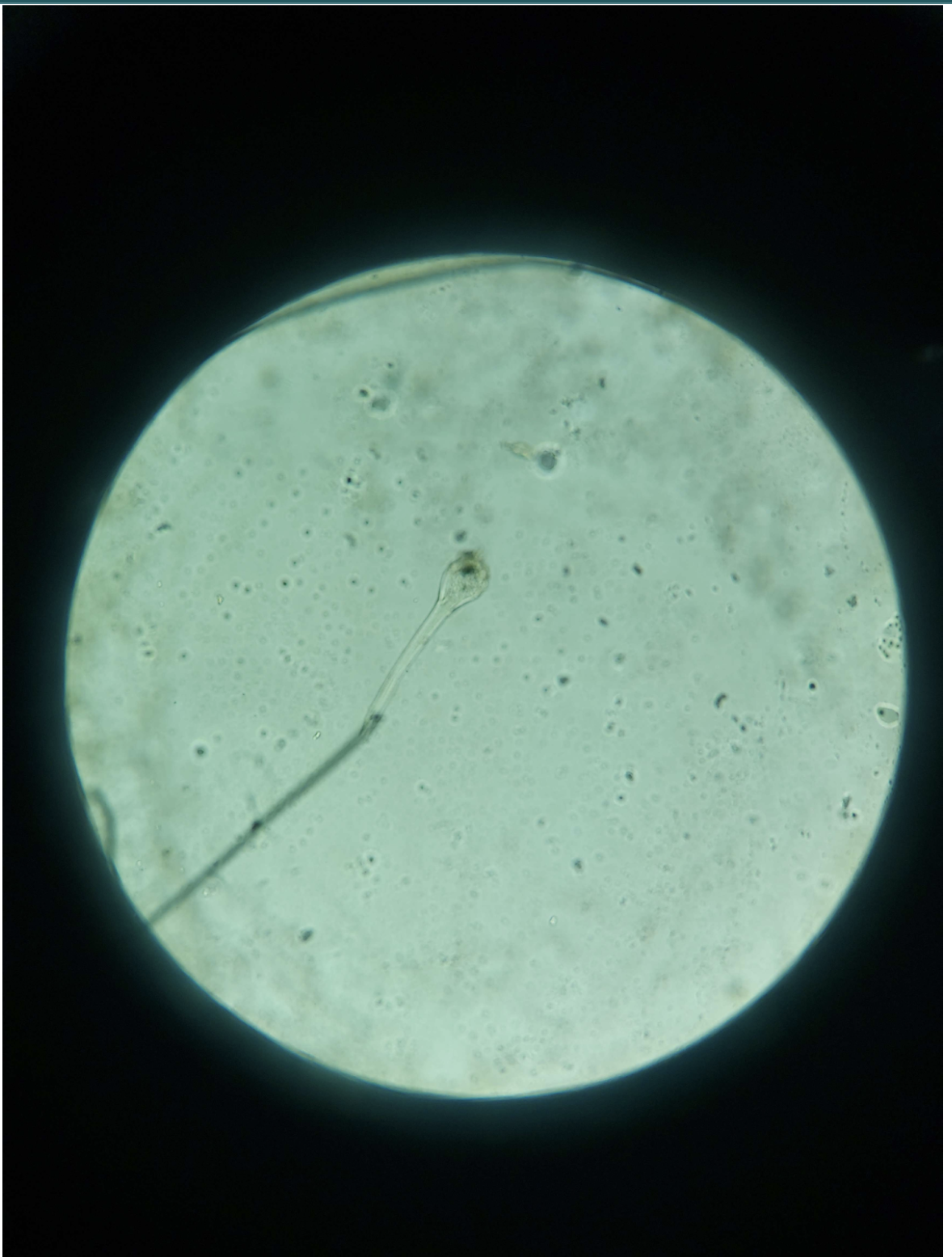 <p>Trichomes</p>