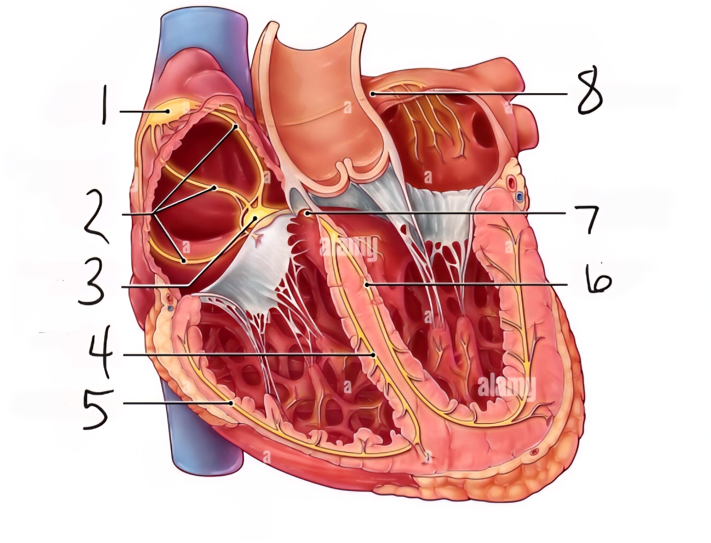 term image