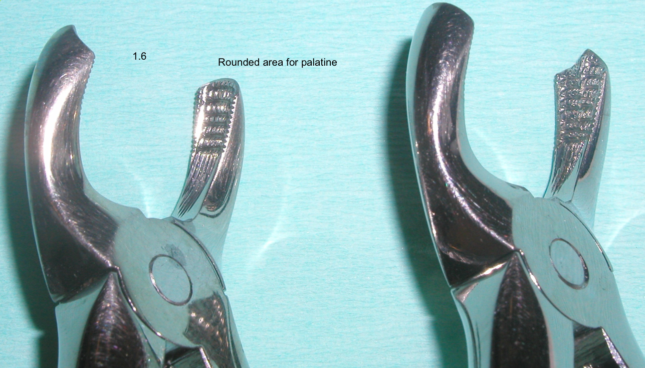 <p>3 divergent roots towards apical-</p><p>Pt- powerful, long and thick cone towards pt</p><p>MB- fine root, short and flattened MD</p><p>DB- thinner and flattened upwards</p><p>Direct relationship with the maxillary sinus (NO ROTATION)</p>