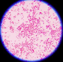 <p>Is this gram-positive or gram-negative bacteria (pink)</p>