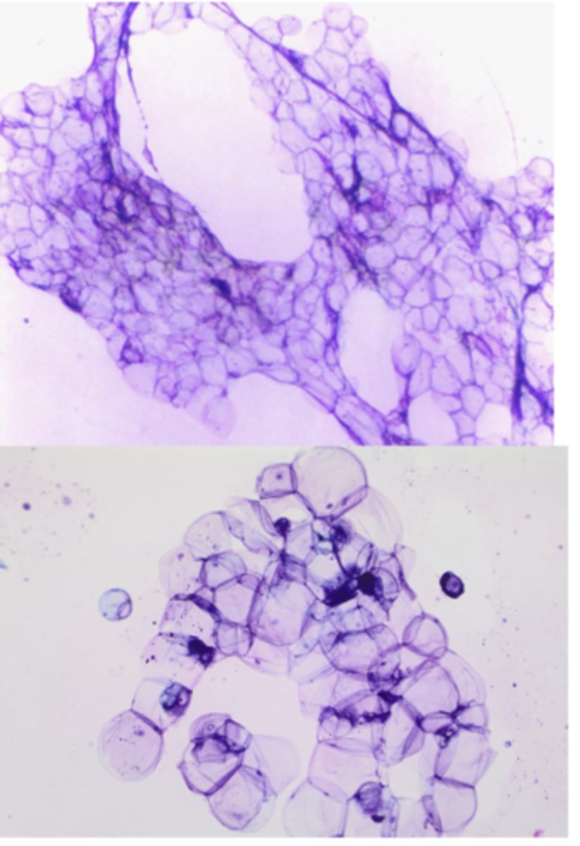 <p>You take a FNA of a soft, movable mass within the subcutis and note this on your sample.</p><p>What is youe top differential?</p>