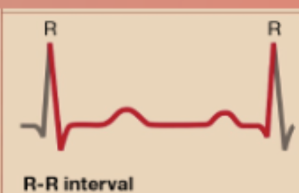 <p>R-R Interval</p>