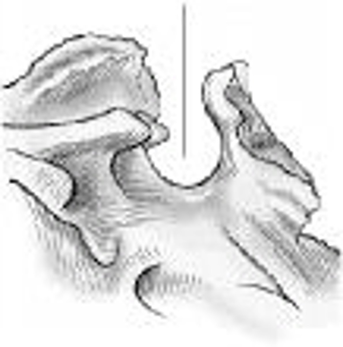 <p>What part of the sphenoid is identified?</p>