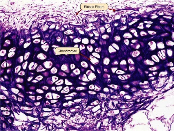 <p>Elastic Cartilage — Description</p>