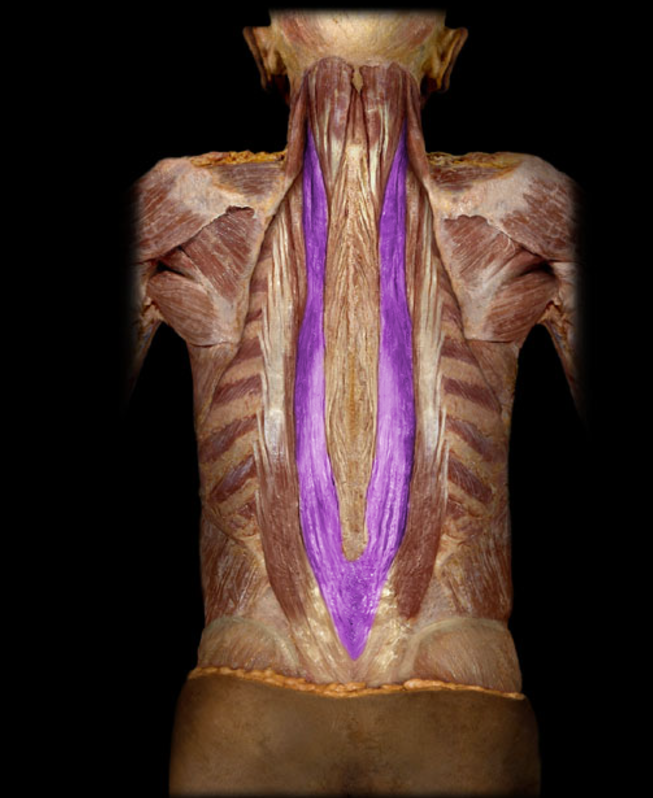 <p>Longissimus thoracis</p>