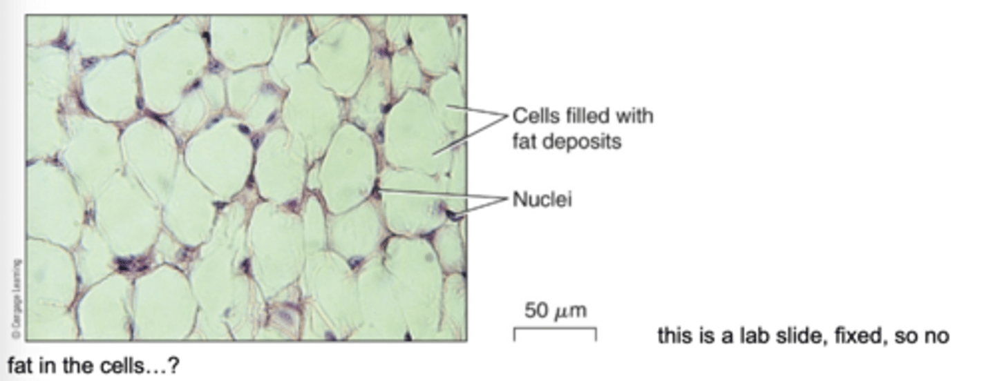 <p>- Have a large middle vacuole, which is filled with fat (lipids) so the cells look hollow.</p><p>- Structure: Large vacuole which stores fat, very little extracellular matrix because the fat takes up most of the space, contains reticular fibers (thin support fibers).</p><p>- Function: Cushion organs, support, insulate, and energy storage.</p><p>- Location: Under the skin, around many organs.</p>