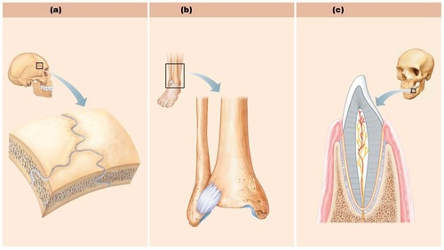 <p>Peg-in-socket joint, e.g., tooth in socket.</p>