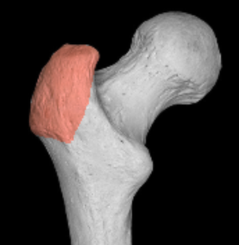 <p>larger bumpy protrusion opposite head of femur </p>
