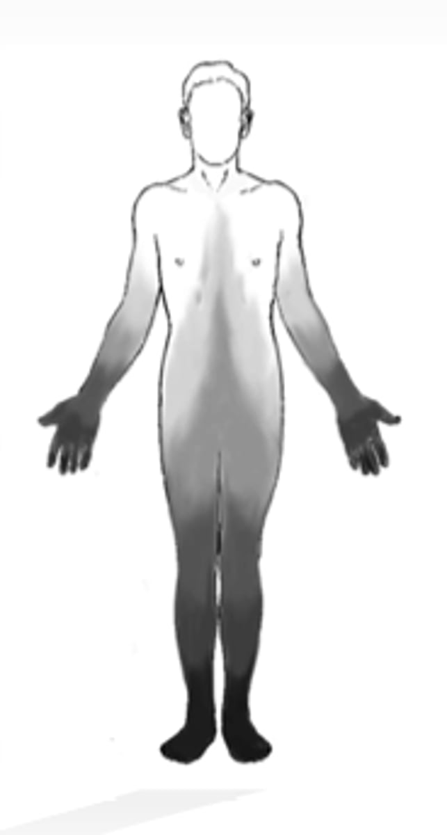 <p>Distal symmetric sensory loss (starts in toes) described as a "stocking-glove" pattern along w/ tingling, burning, &amp; deep aching pain</p>