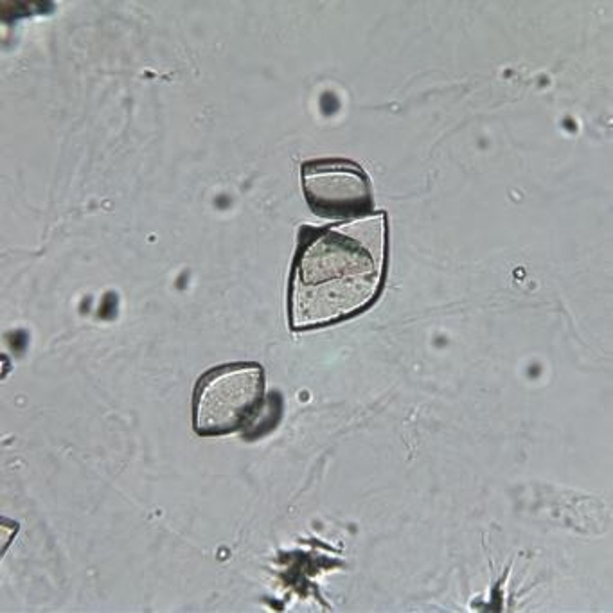 <p>Colorless, vary in size, observed under Brightfield at 40x.</p>