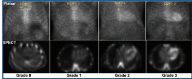 <p>what quantifying method was used in this image</p>