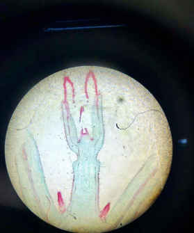 dicot stem