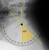 <p>Q what is the name of this measurement? and what is the average + range?</p>
