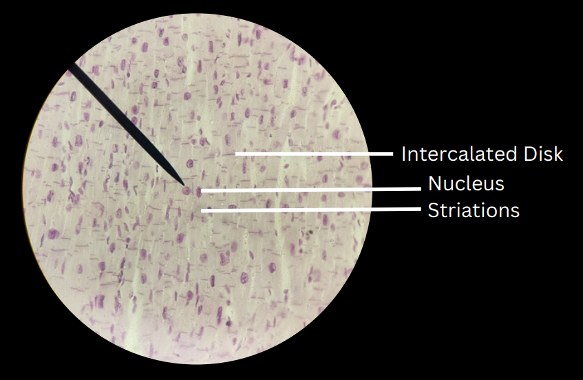 <p>striated, involuntary muscles; separated by intercalated/intercalary disks</p>