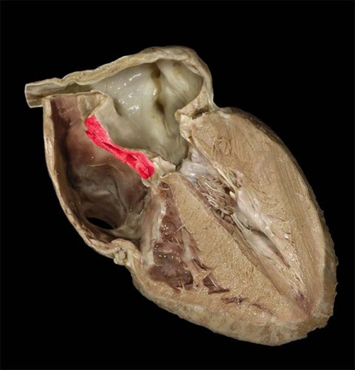 <p>divides the right and left atrium</p>