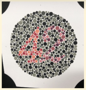 <ul><li><p>Found toward the end of the test</p><ul><li><p>Designed for pts not no literate</p></li></ul></li><li><p><strong>Protans:</strong> See numbers on the <strong>right</strong> (e.g., 2)</p></li><li><p><strong>Deutans:</strong> See numbers on the <strong>left</strong> (e.g., 4)</p></li><li><p>Those w/ severe R-G defects (esp protanopia) may not see either</p></li></ul><p></p>