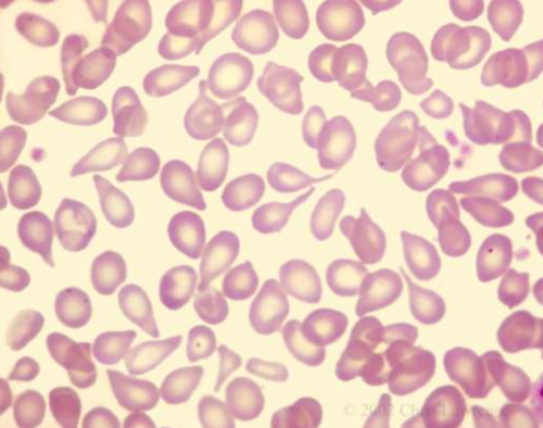 <p>formation of blood cells and occurs in the bone marrow</p>