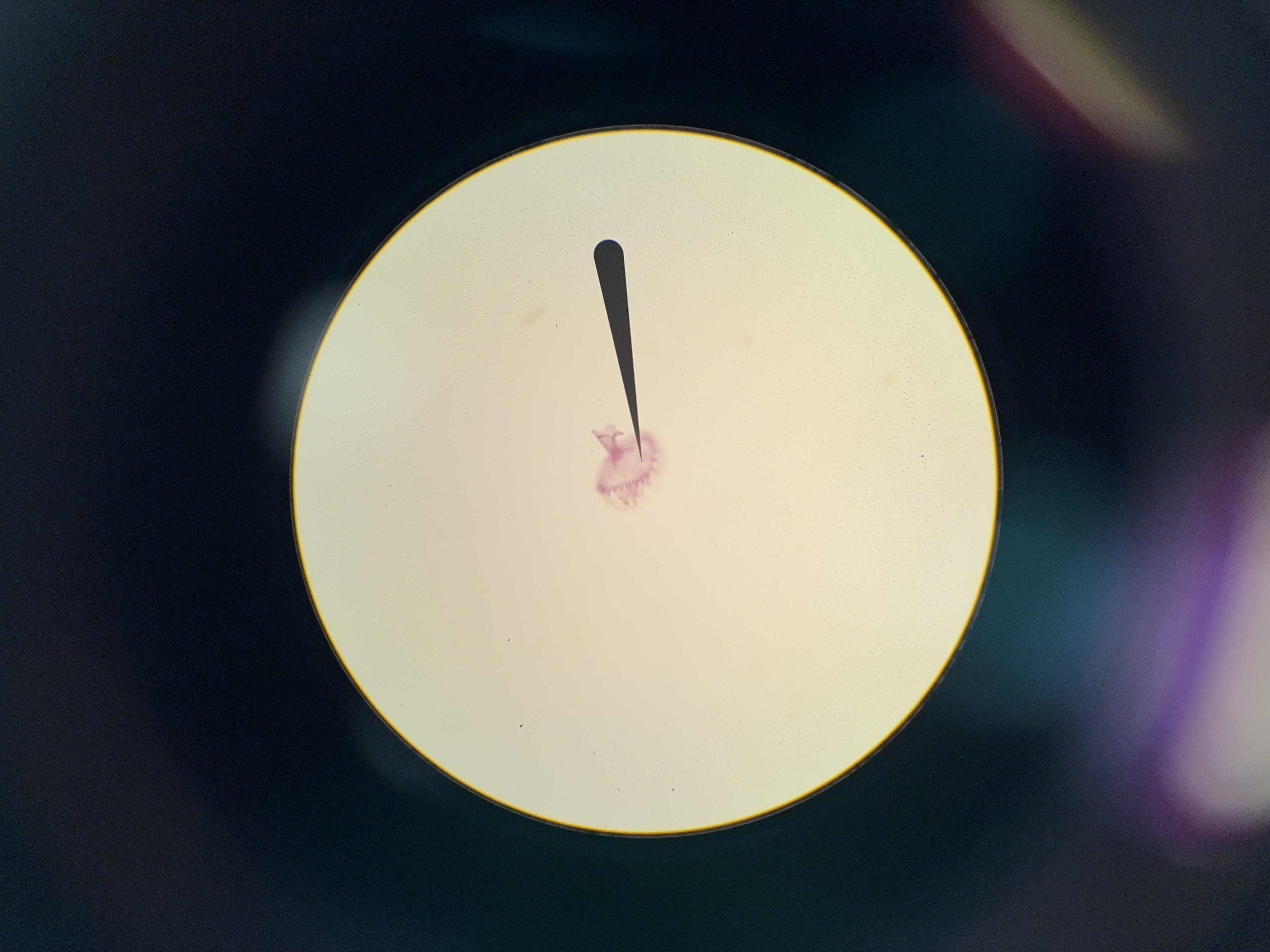 <p>2nd stage of the scyphozoa development</p>