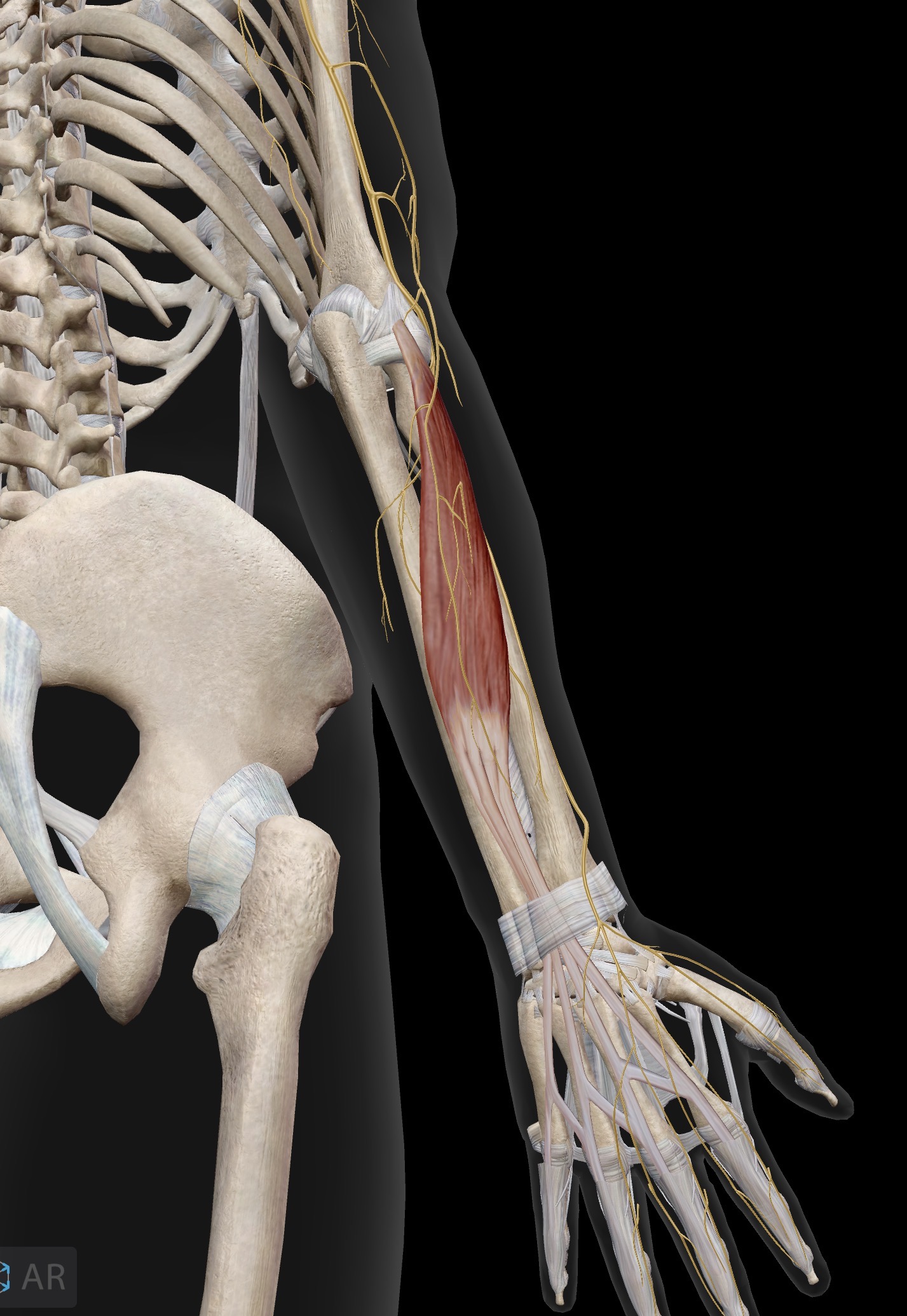 <p>Extensor digitorum</p><p>O: Lateral epicondyle of humerus (common extensor origin)</p><p>I: Bases of middle and distal phalanges of the 2nd-5th digits (dorsal surfaces)</p><p>A: Extension of the fingers at the MCP, PIP, and DIP joints. Extension of the hand at the wrist joint.</p><p>IN: Radial nerve (C5-C8, T1)</p>