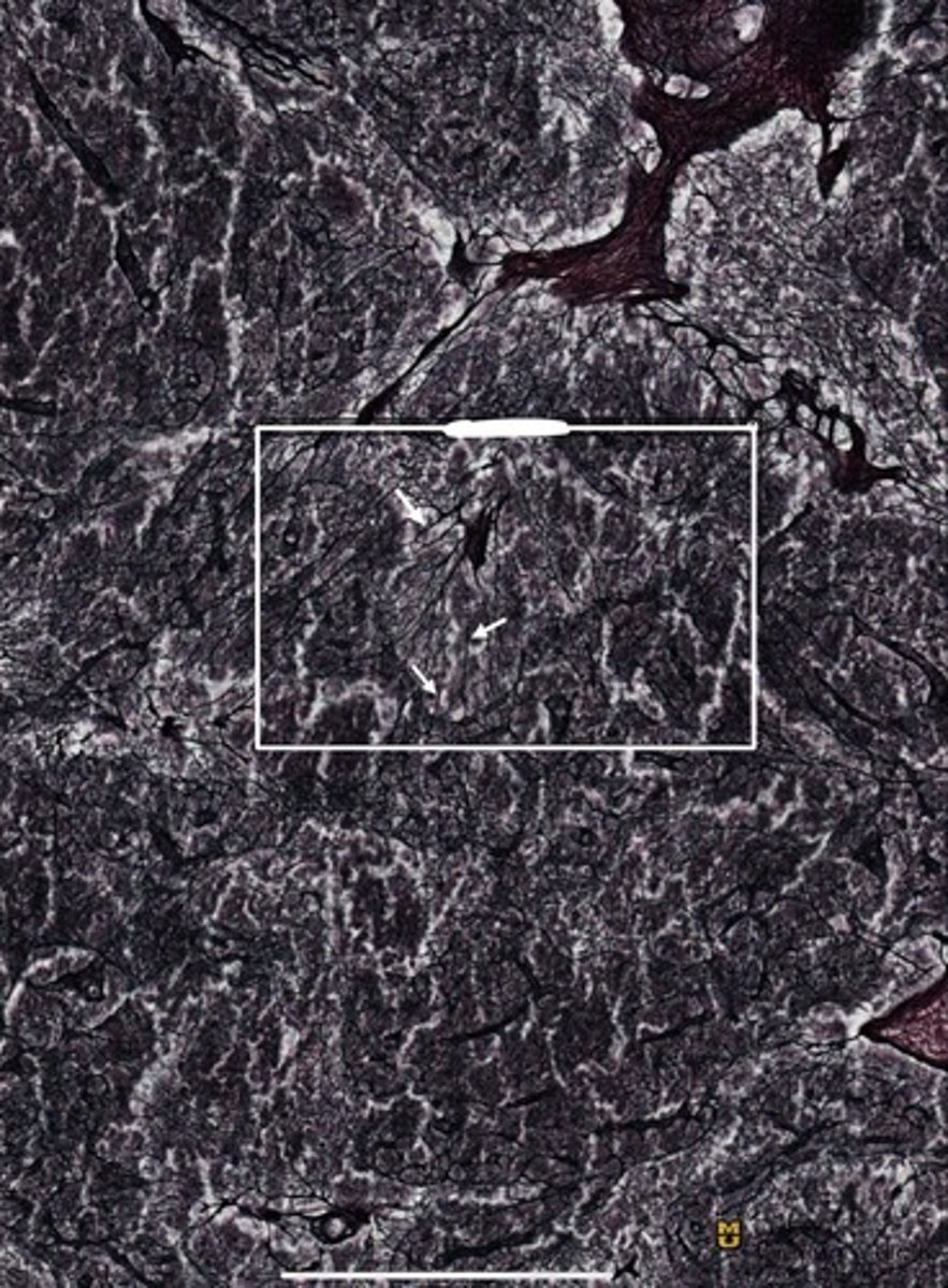 <p>What tissue type is shown as a whole?</p><p>What structures are the white arrows pointing to?</p>