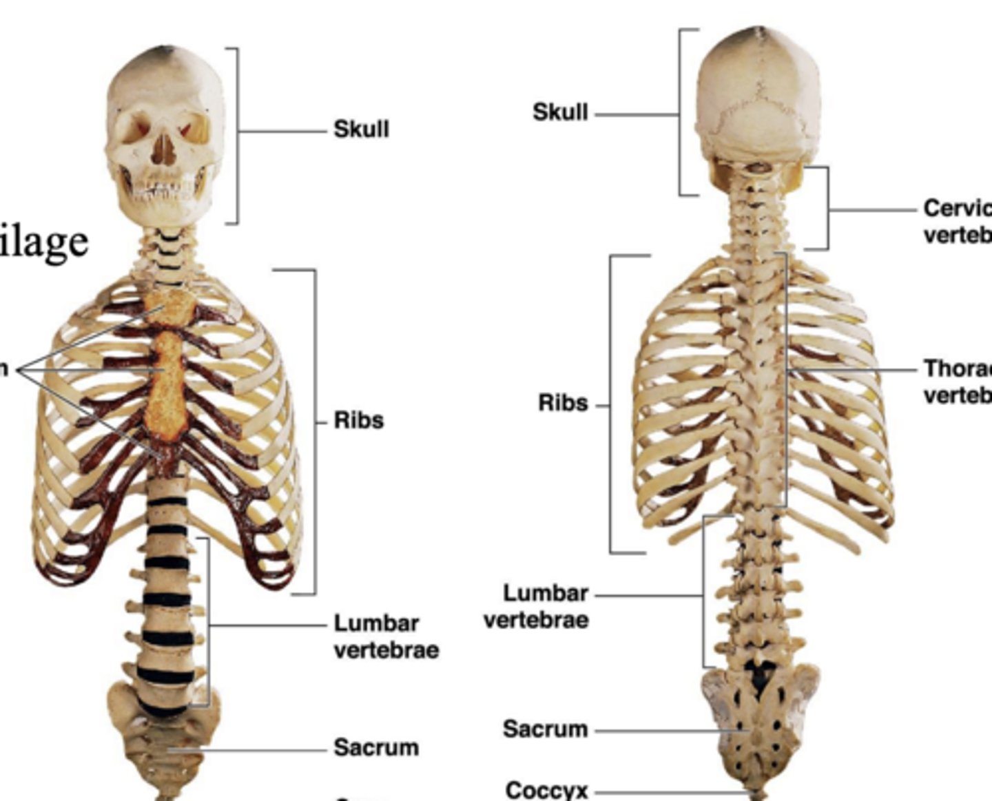 <p>Ribs</p><p>• Sternum</p><p>• Thoracic vertebrae</p><p>• Costal cartilage</p>